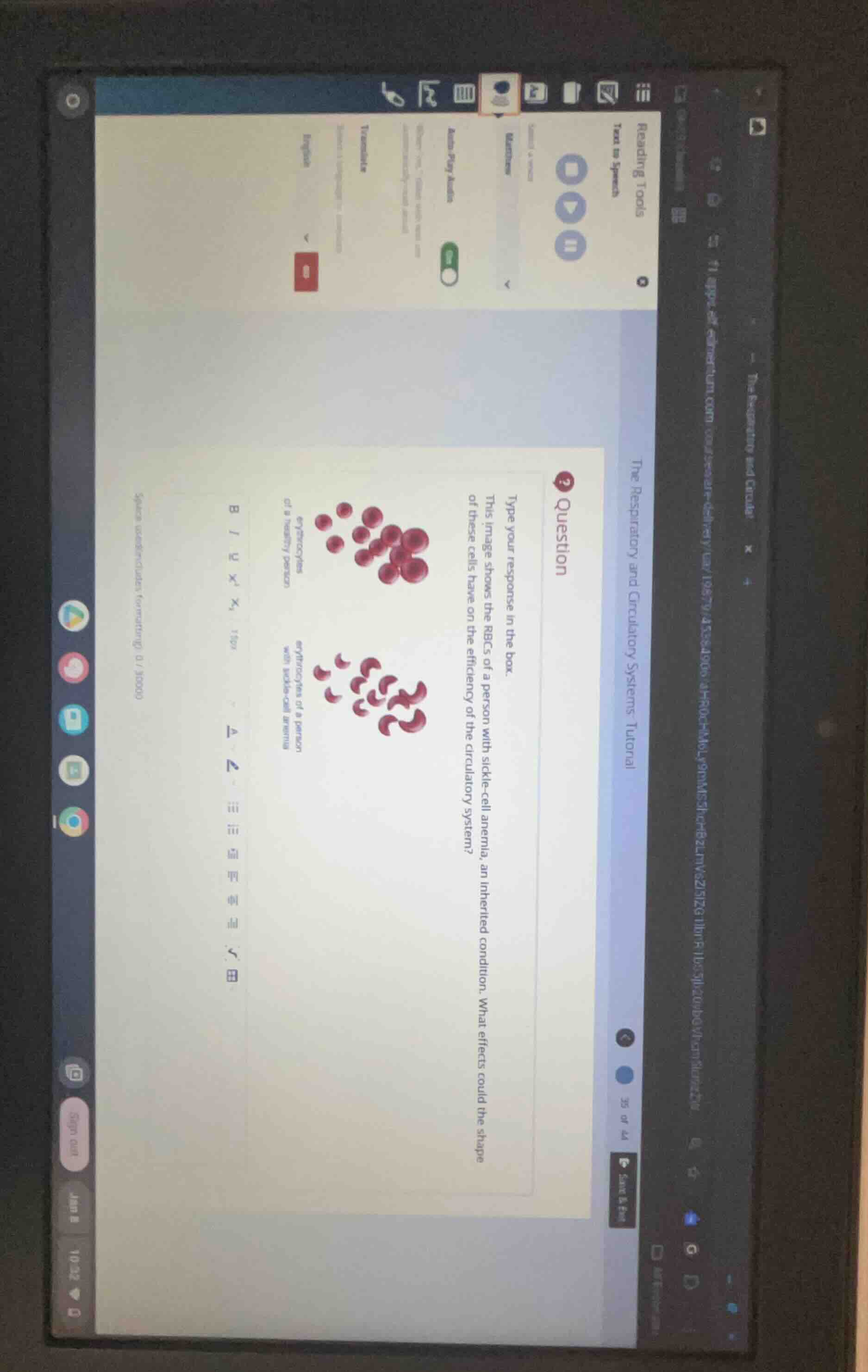 question type your response in the box. this image shows the rbcs of a …