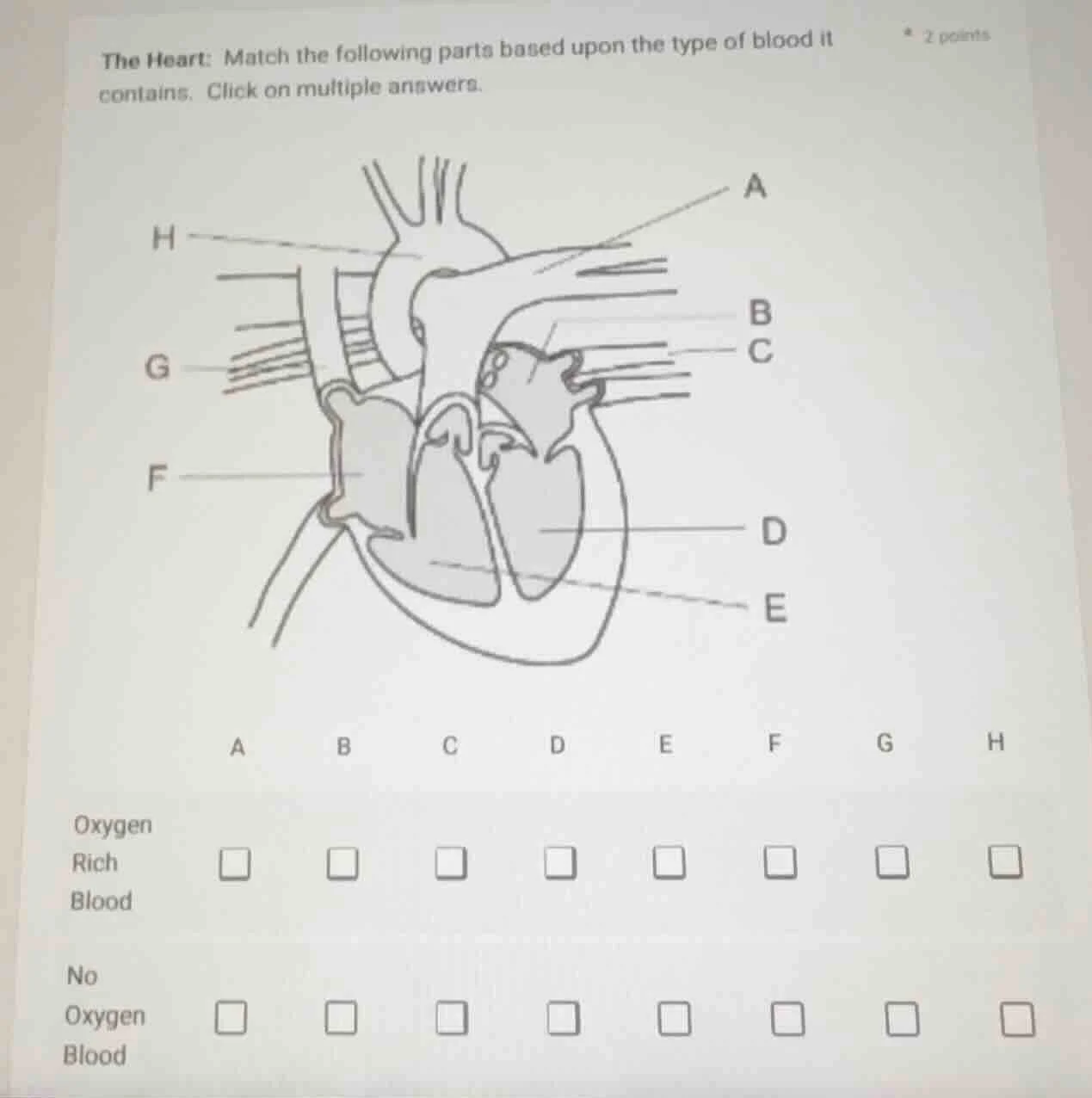 the heart: match the following parts based upon the type of blood it co…