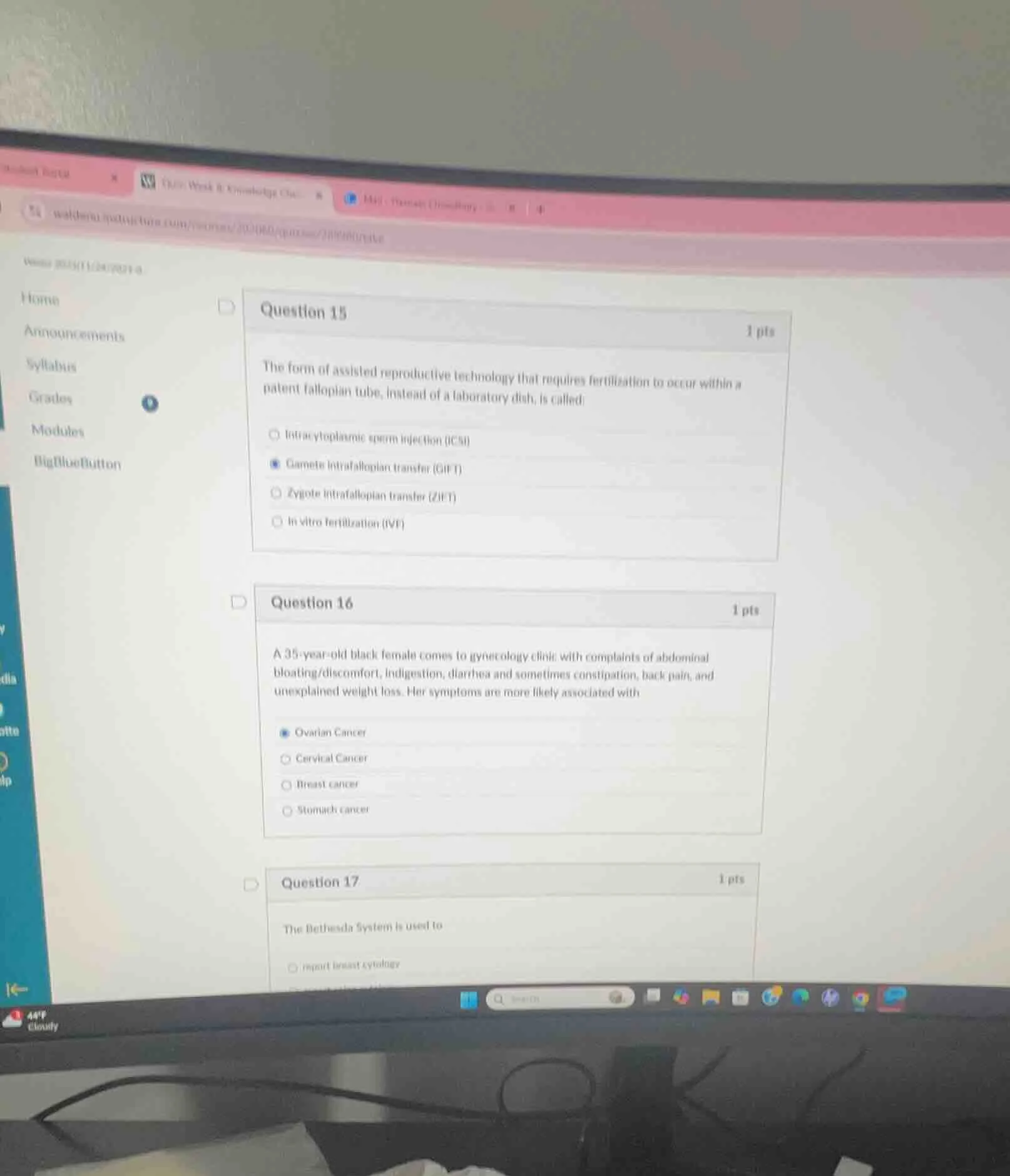 question 15 1 pts the form of assisted reproductive technology that req…