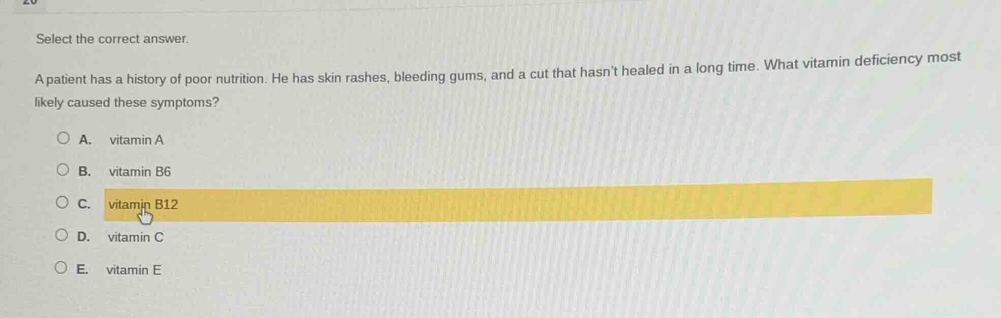 select the correct answer. a patient has a history of poor nutrition. h…