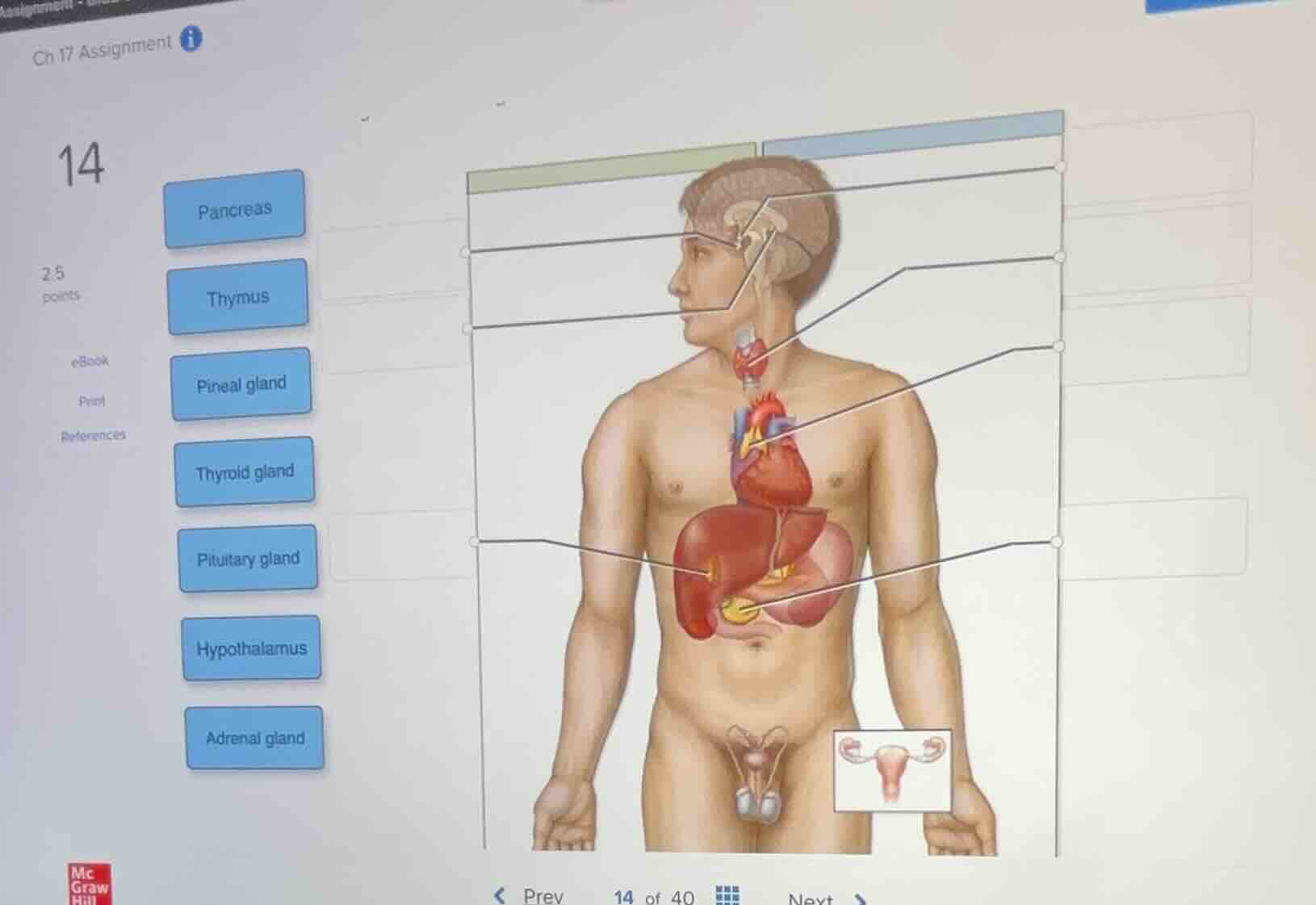 ch 17 assignment 14 2.5 points ebook print references pancreas thymus p…