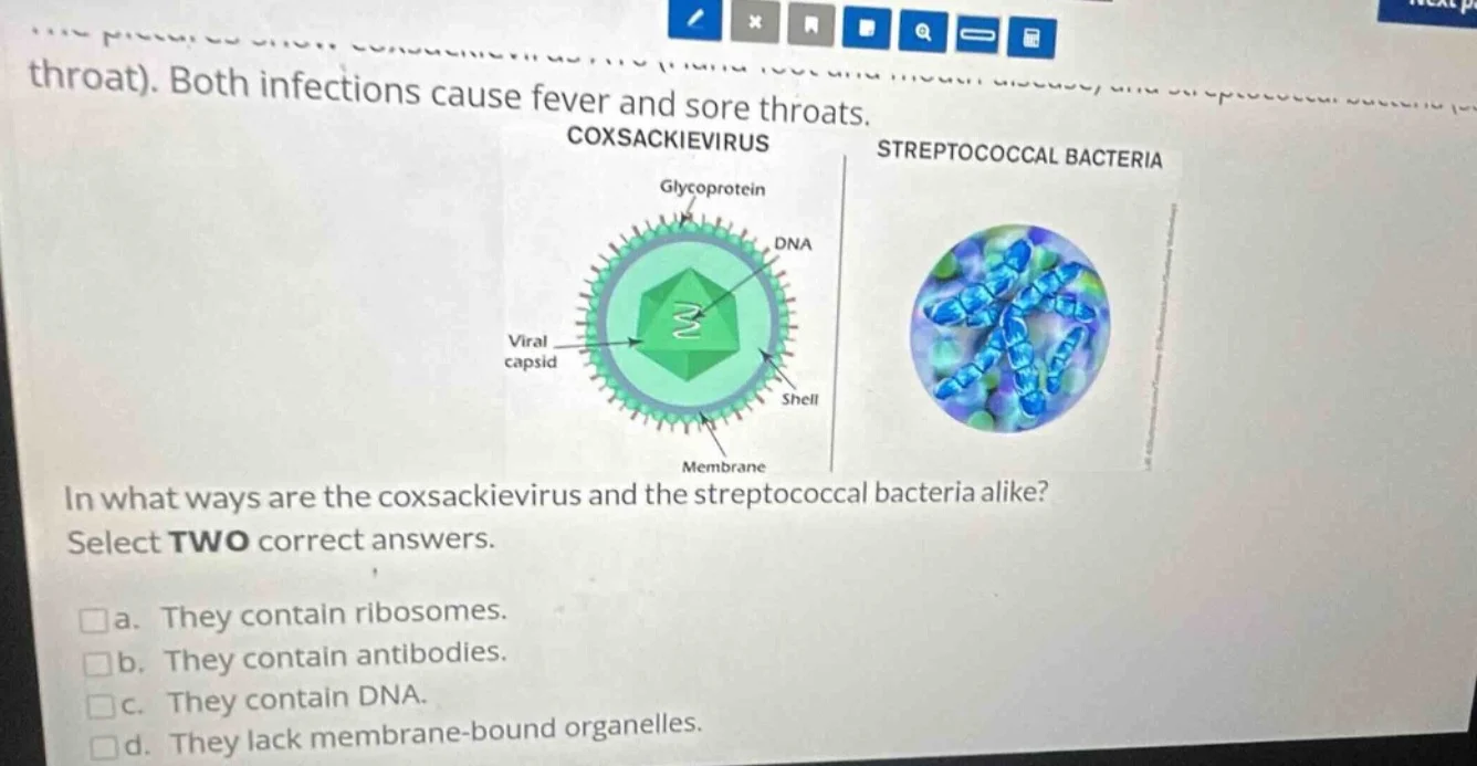 throat). both infections cause fever and sore throats. coxsackievirus s…