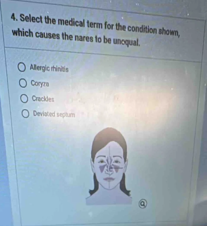 4. select the medical term for the condition shown, which causes the na…