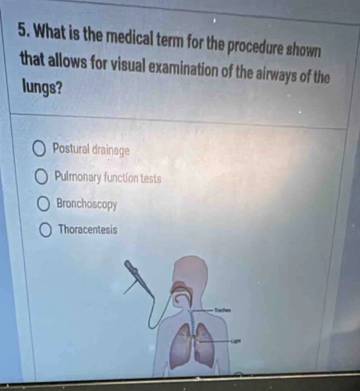 5. what is the medical term for the procedure shown that allows for vis…