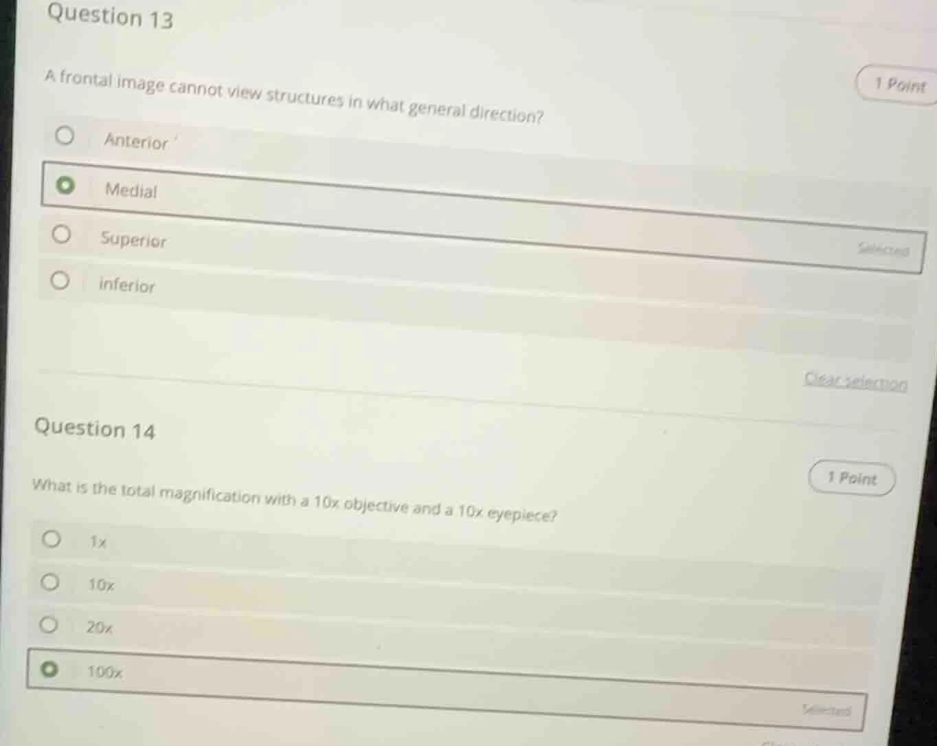 question 13 a frontal image cannot view structures in what general dire…