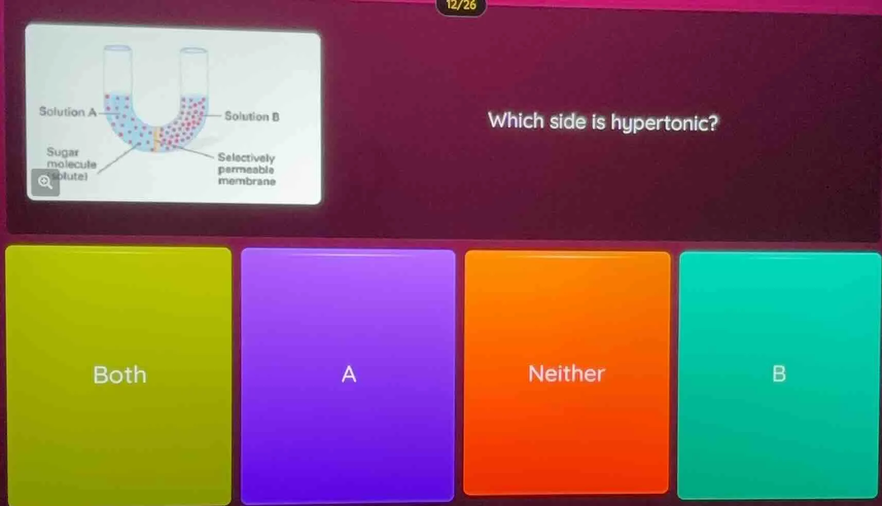 which side is hypertonic? options: both, a, neither, b (with an image o…