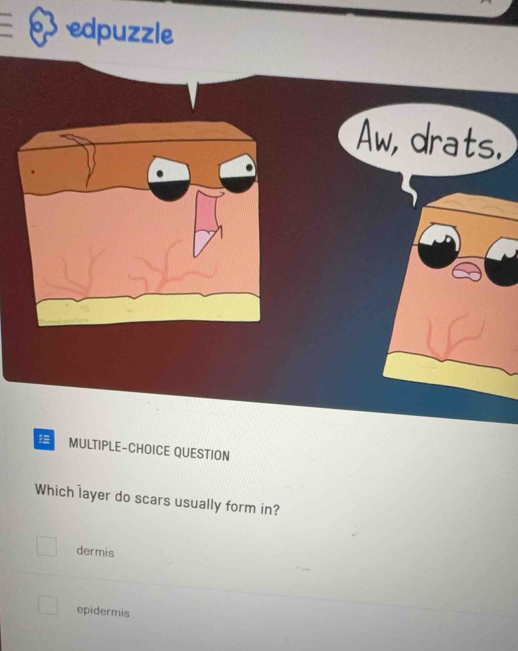 multiple-choice question which layer do scars usually form in? dermis e…