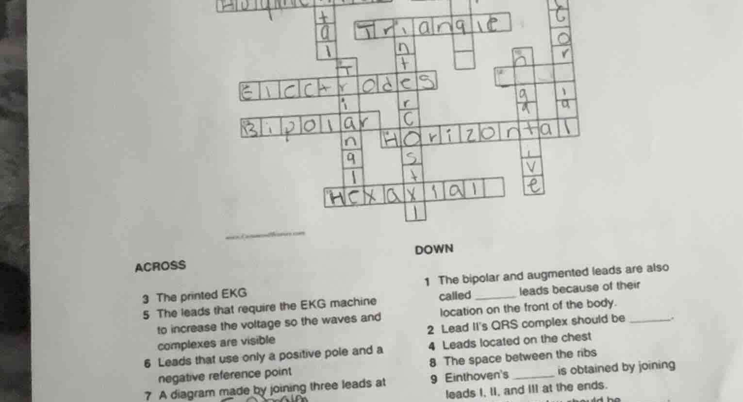 across 3 the printed ekg 5 the leads that require the ekg machine to in…