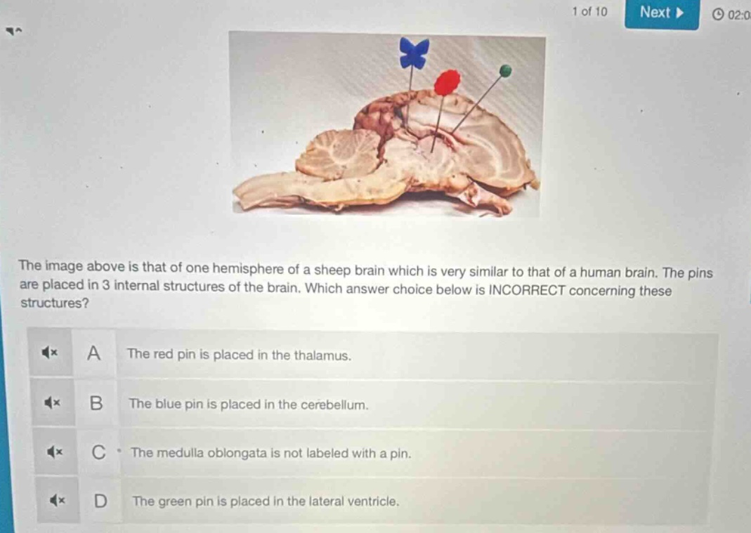 the image above is that of one hemisphere of a sheep brain which is ver…