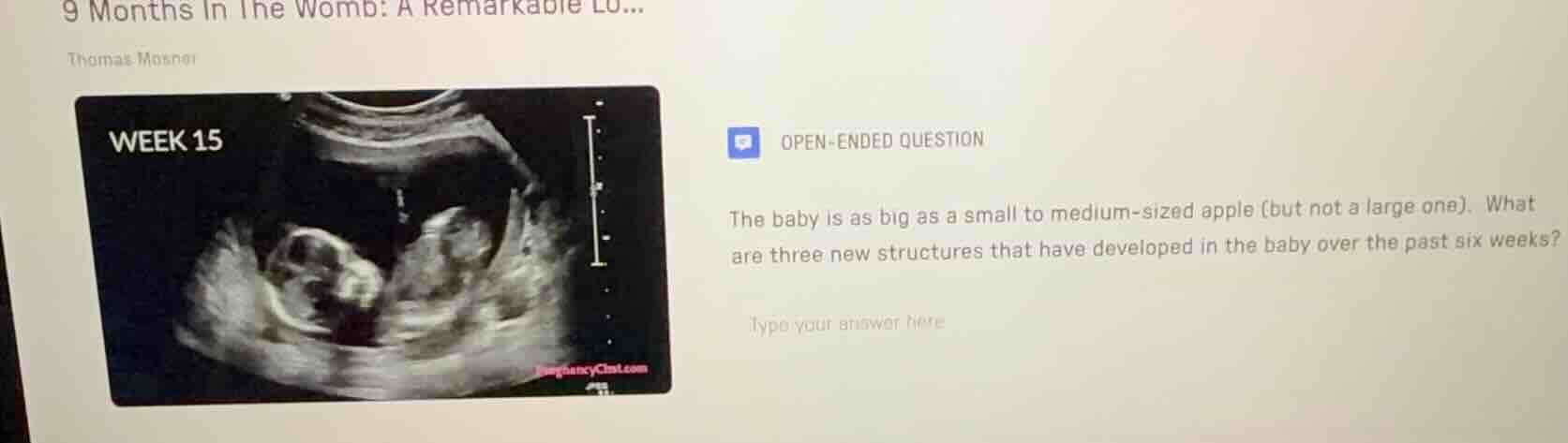 9 months in the womb: a remarkable lo... thomas mosner open - ended que…