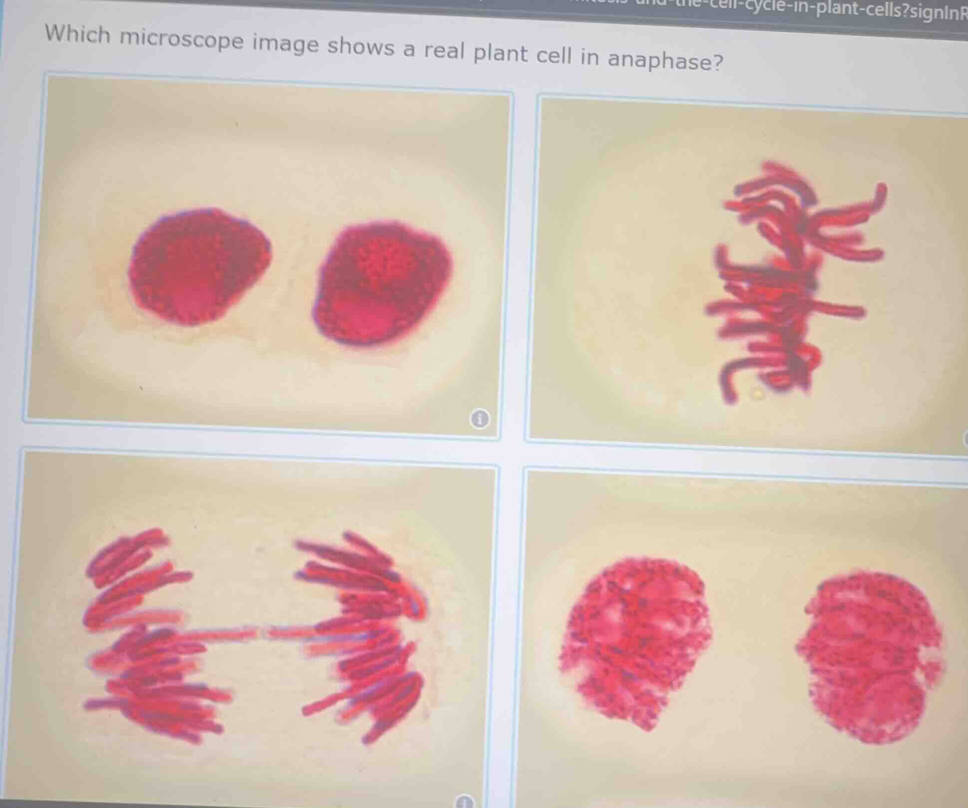 which microscope image shows a real plant cell in anaphase?