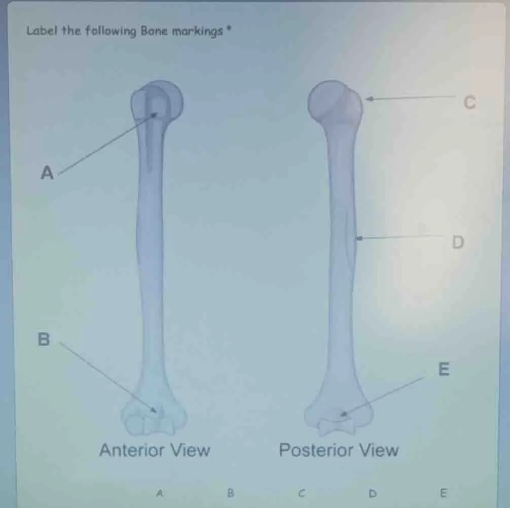 label the following bone markings * anterior view posterior view a b c …