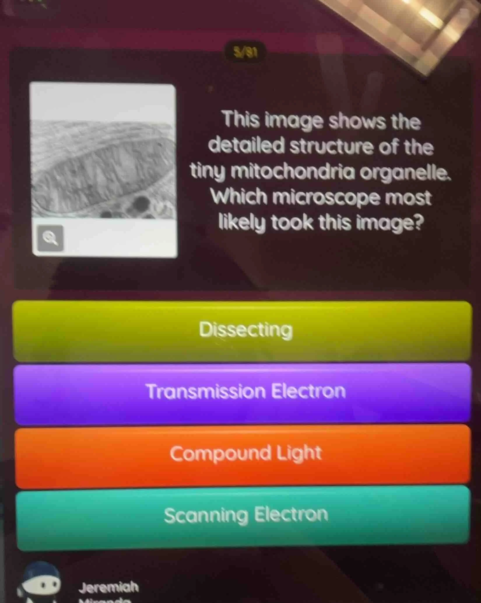 this image shows the detailed structure of the tiny mitochondria organe…
