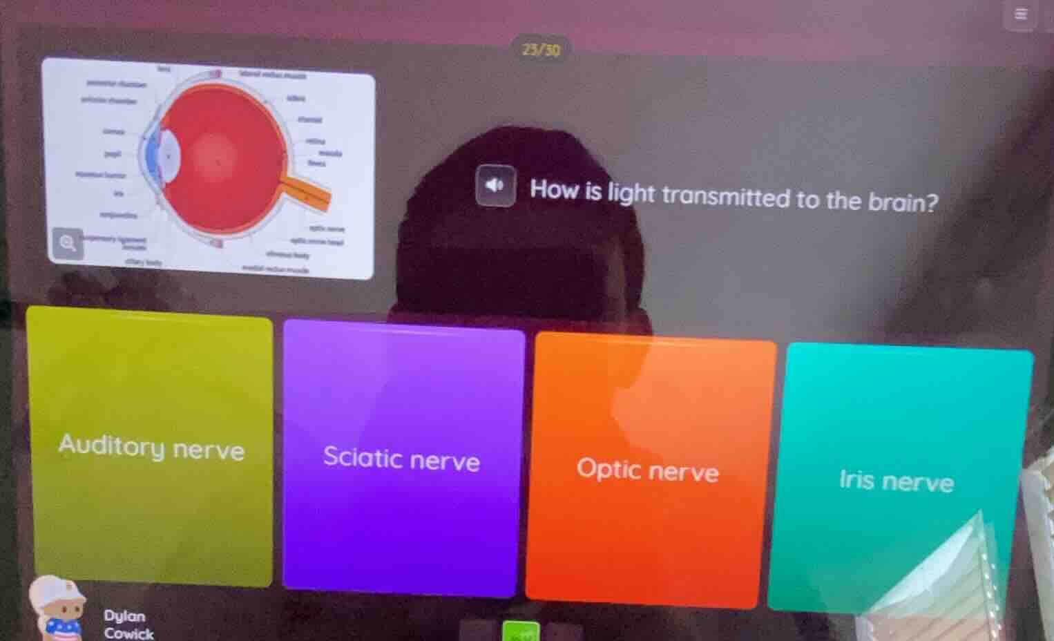 how is light transmitted to the brain? auditory nerve sciatic nerve opt…