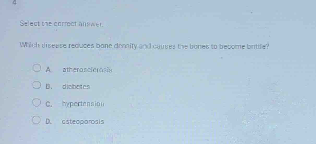 select the correct answer. which disease reduces bone density and cause…
