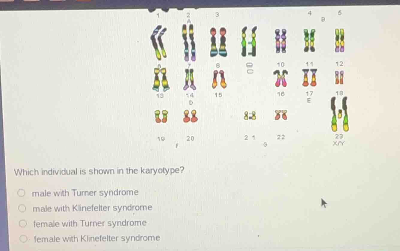 which individual is shown in the karyotype? male with turner syndrome m…