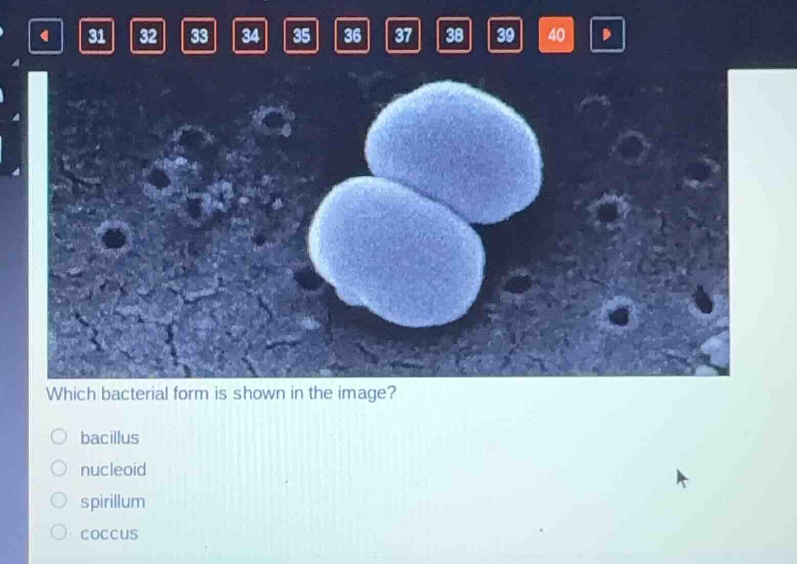which bacterial form is shown in the image? bacillus nucleoid spirillum…