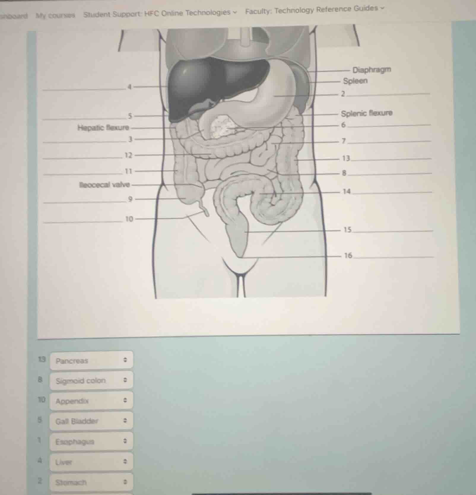 13 pancreas 8 sigmoid colon 10 appendix 5 gall bladder 1 esophagus 4 li…
