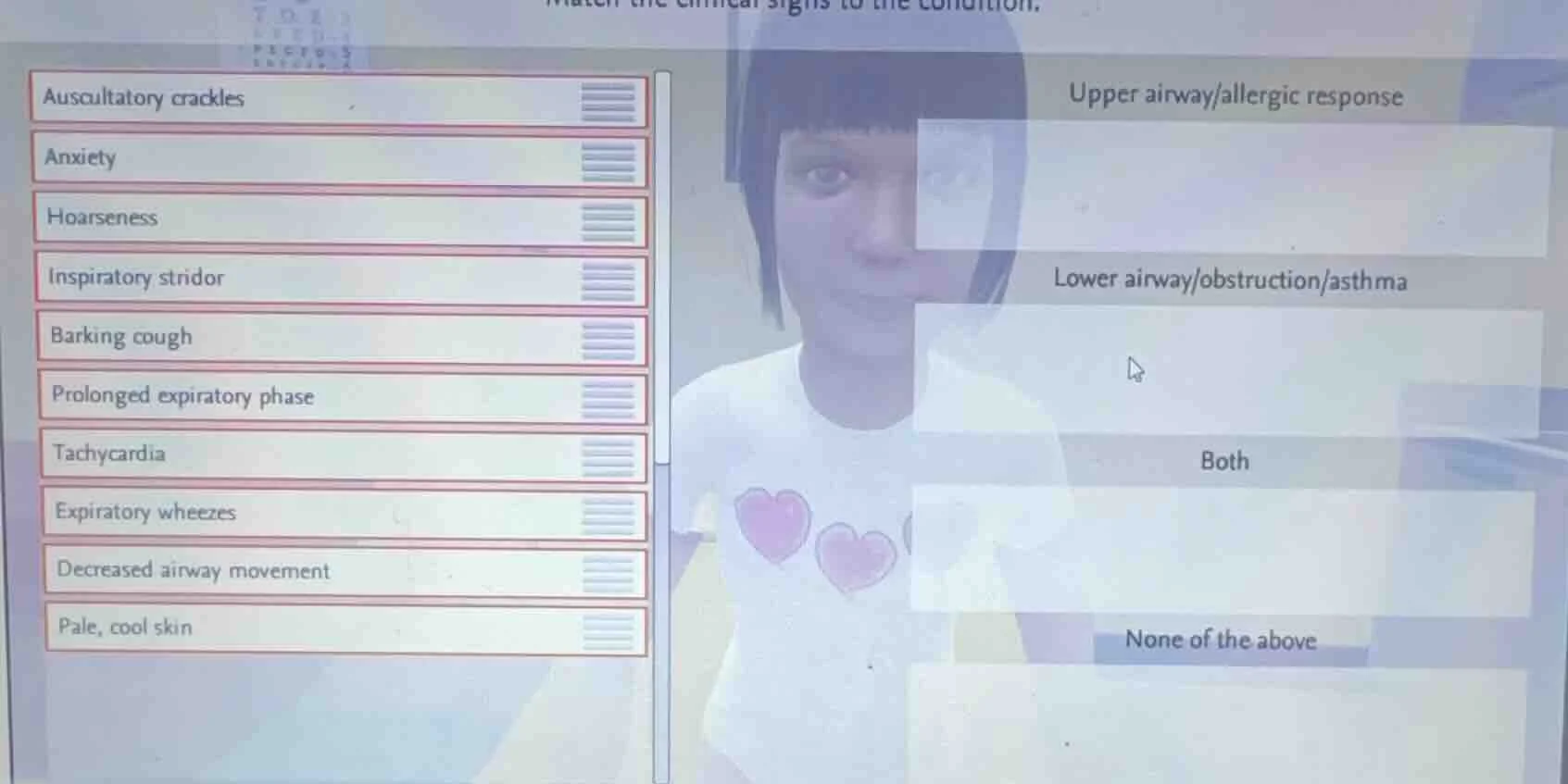 match the clinical signs to the condition. auscultatory crackles anxiet…