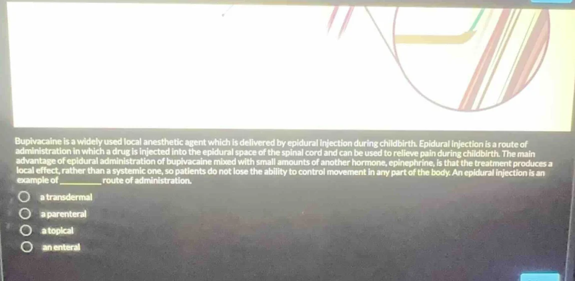bupivacaine is a widely used local anesthetic agent which is delivered …