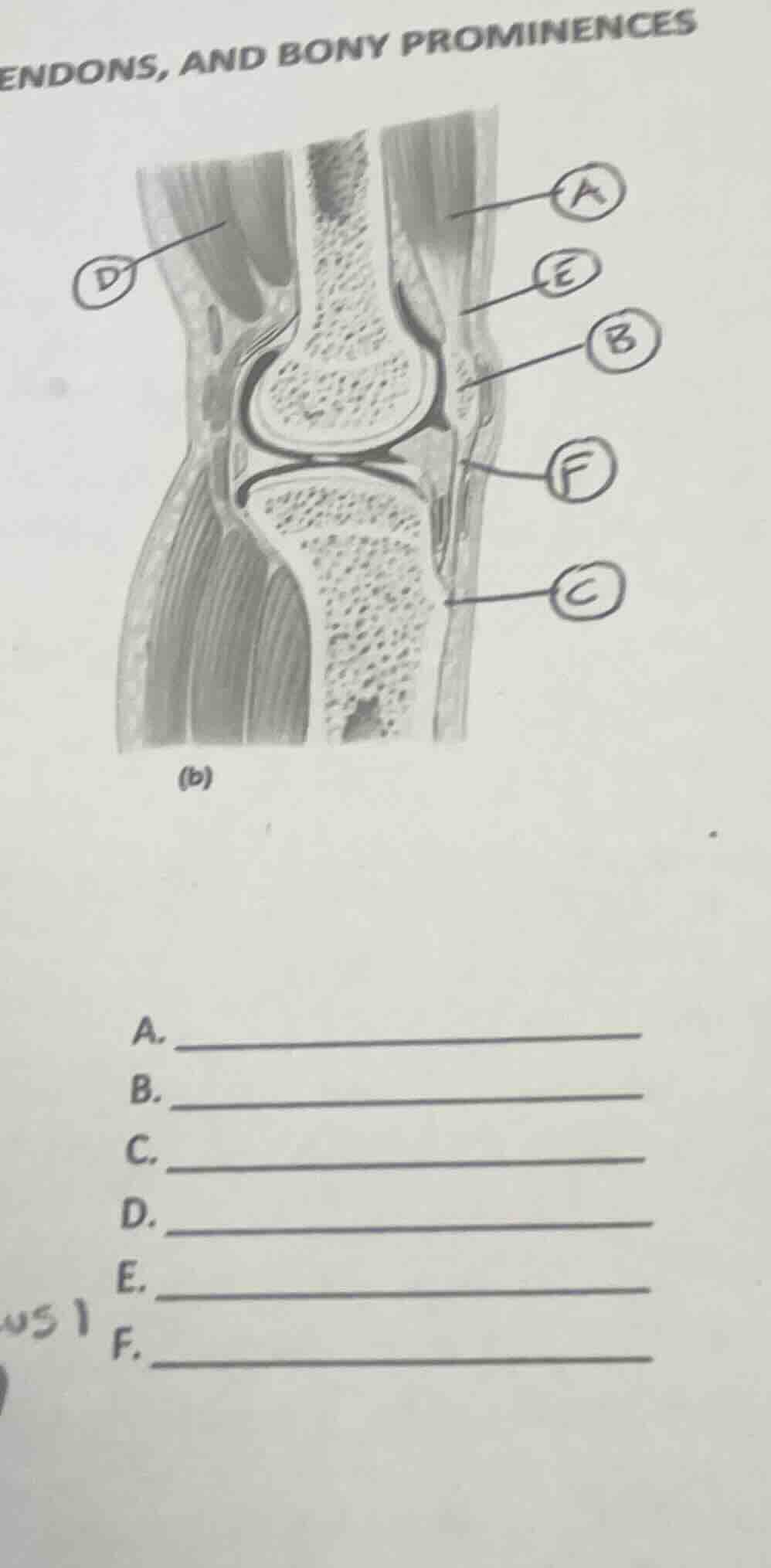 endons, and bony prominences a. b. c. d. e. f.