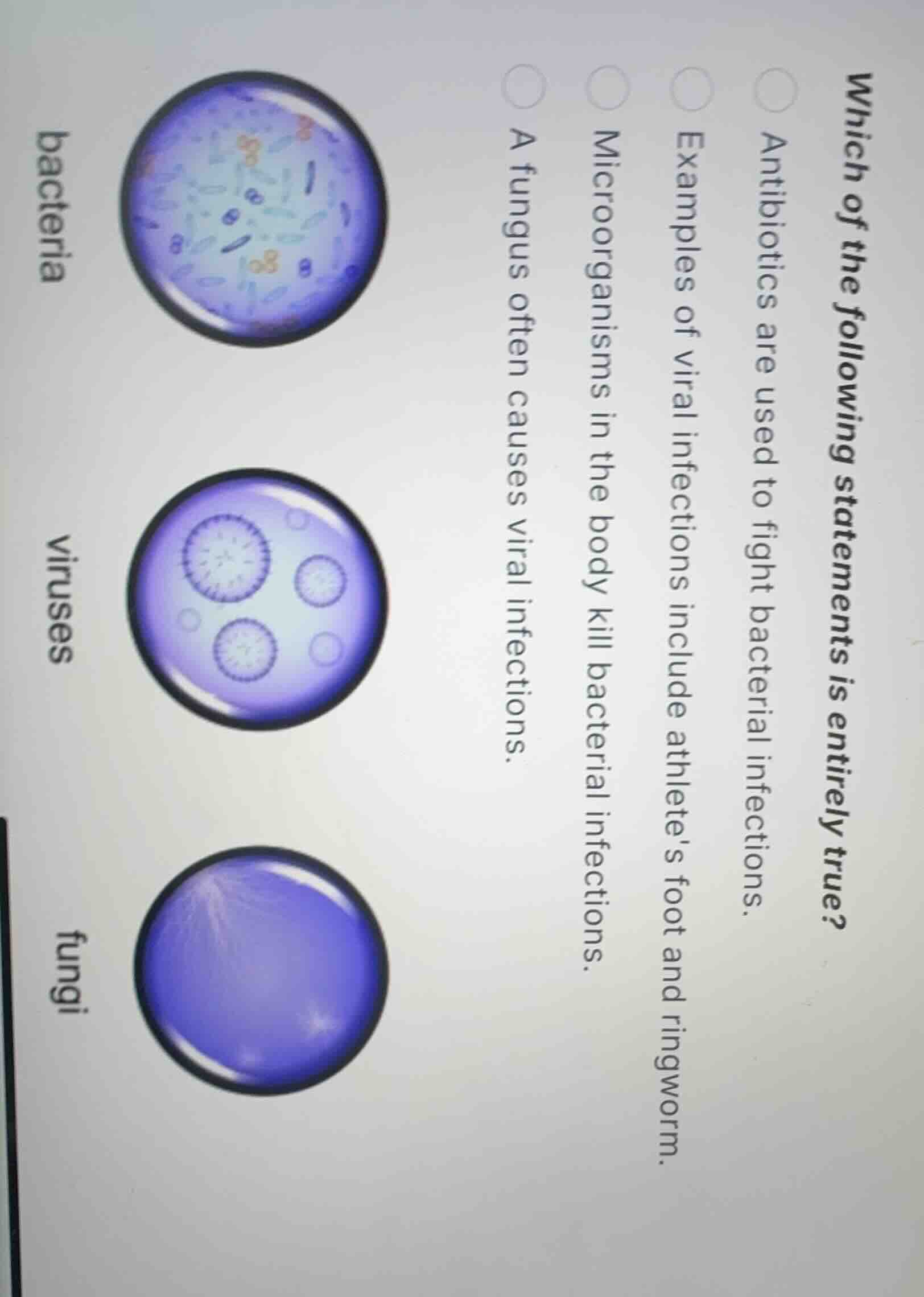 which of the following statements is entirely true? antibiotics are use…