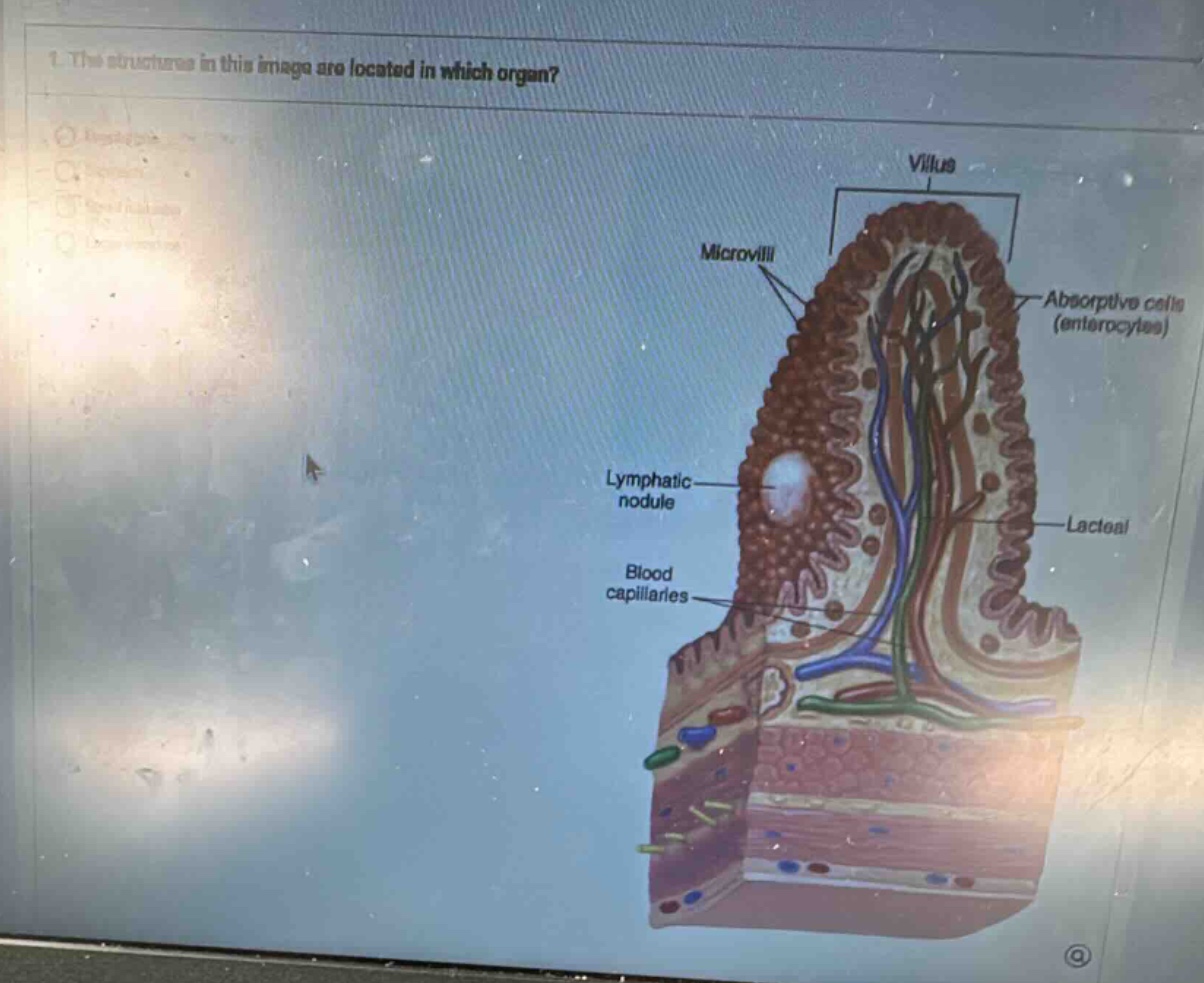 1. the structures in this image are located in which organ? villus micr…