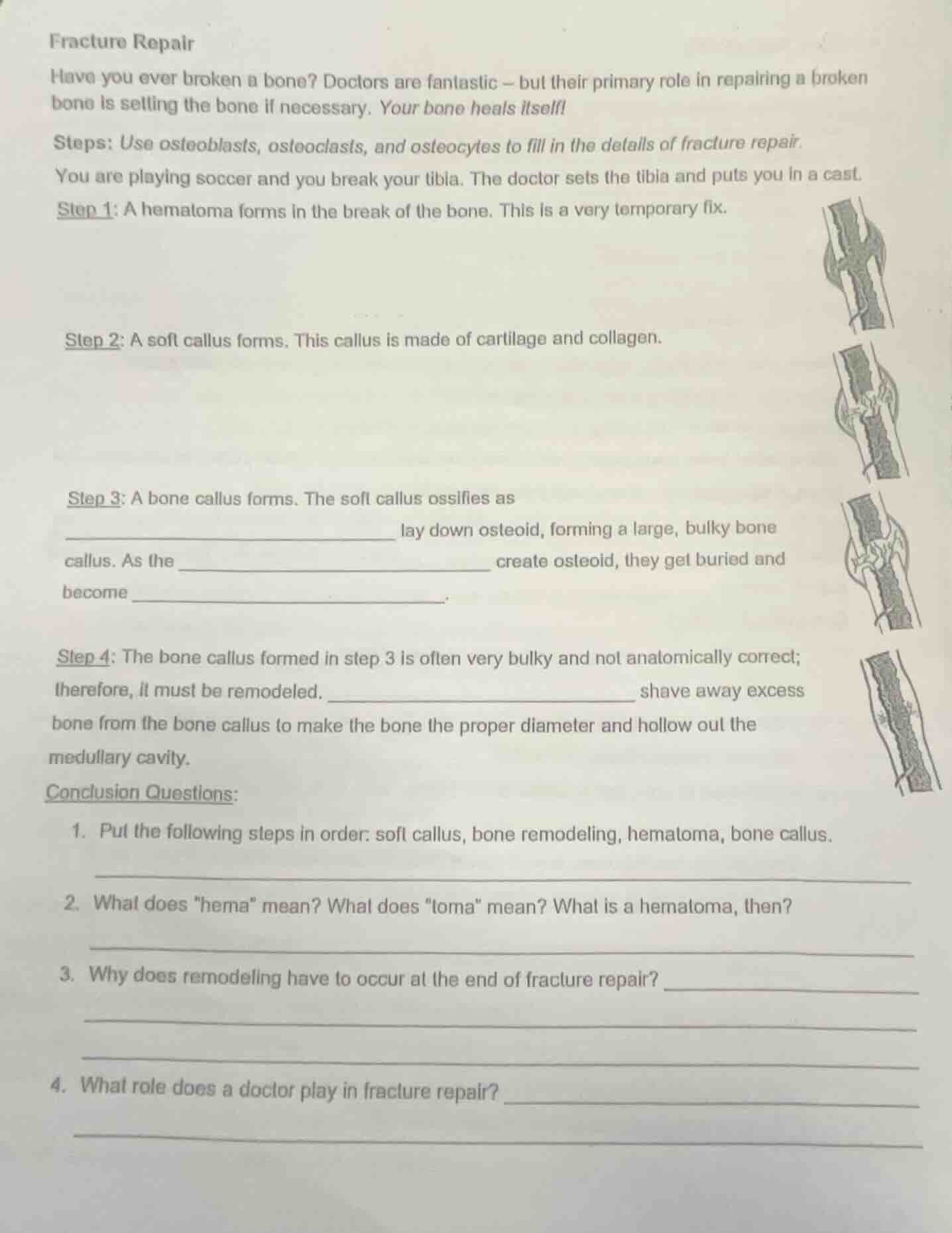 fracture repair have you ever broken a bone? doctors are fantastic – bu…