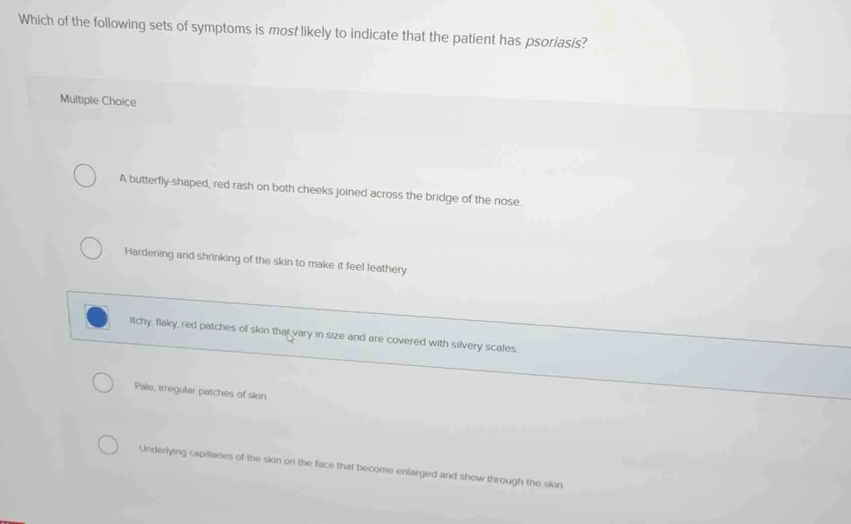 which of the following sets of symptoms is most likely to indicate that…