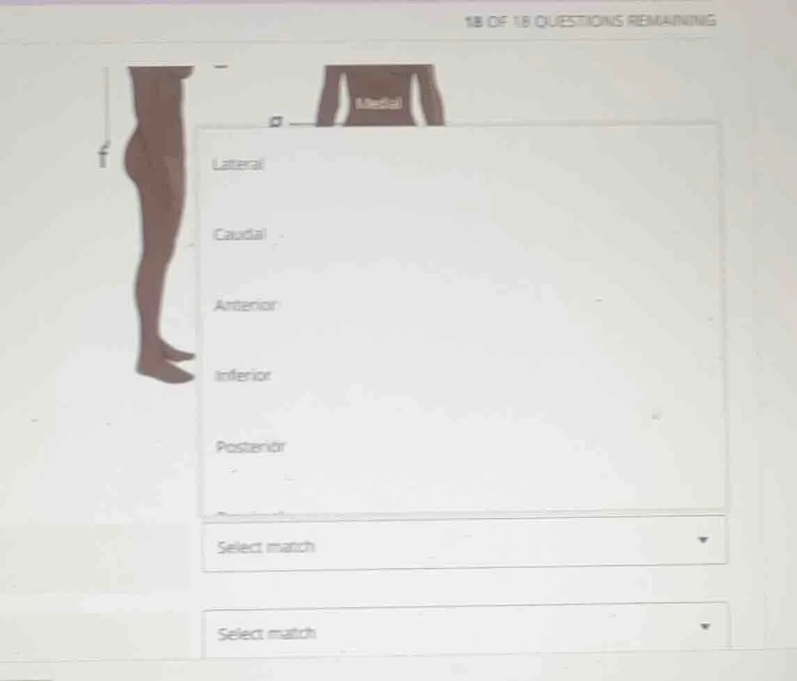 lateral\ caudal\ anterior\ inferior\ posterior\ select match\ select ma…