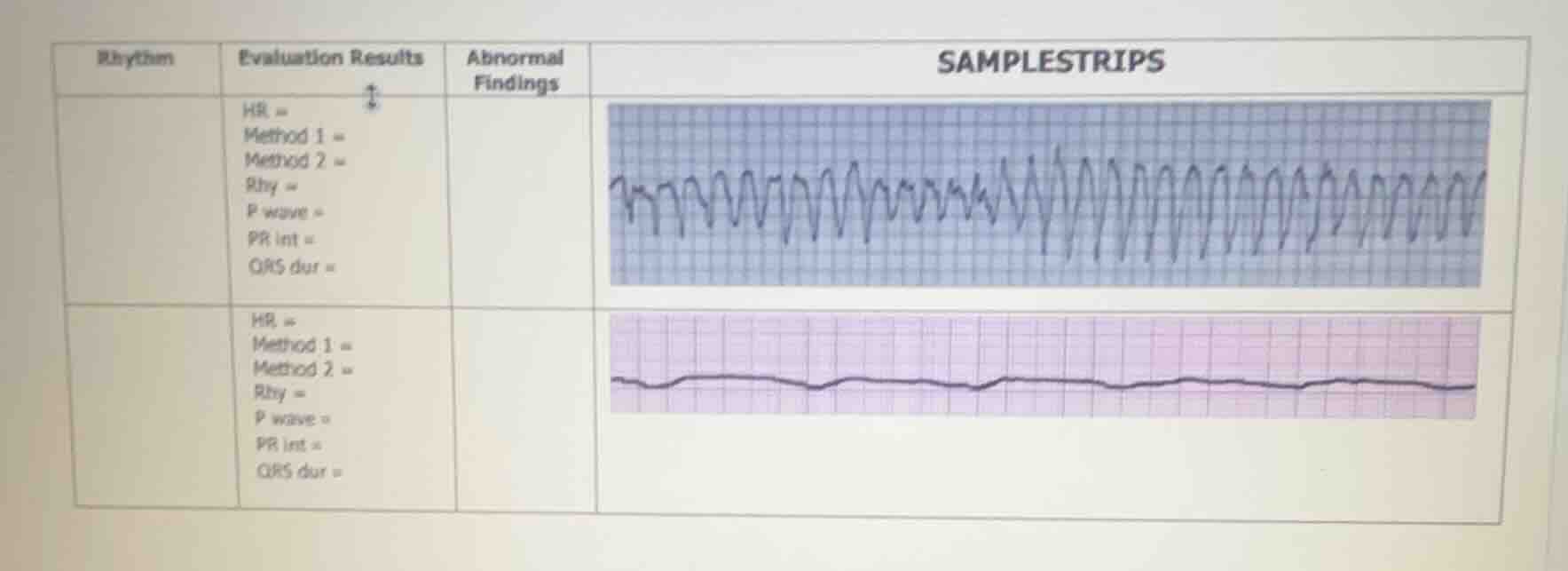 rhythm evaluation results abnormal findings samplestrips hr = method 1 …