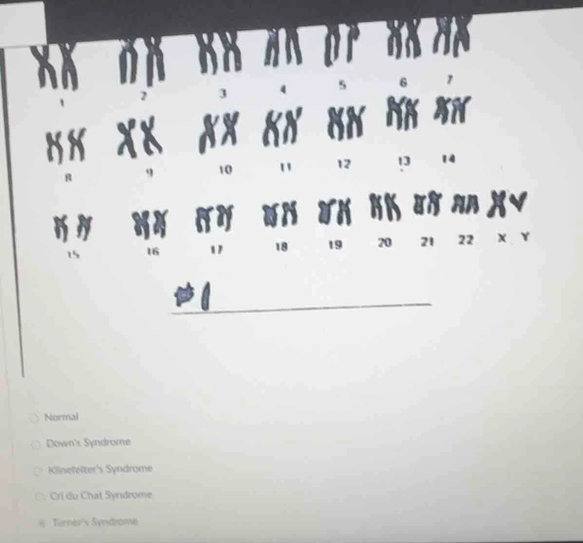 1 2 3 4 5 6 7 8 9 10 11 12 13 14 15 16 17 18 19 20 21 22 x y #1normaldo…