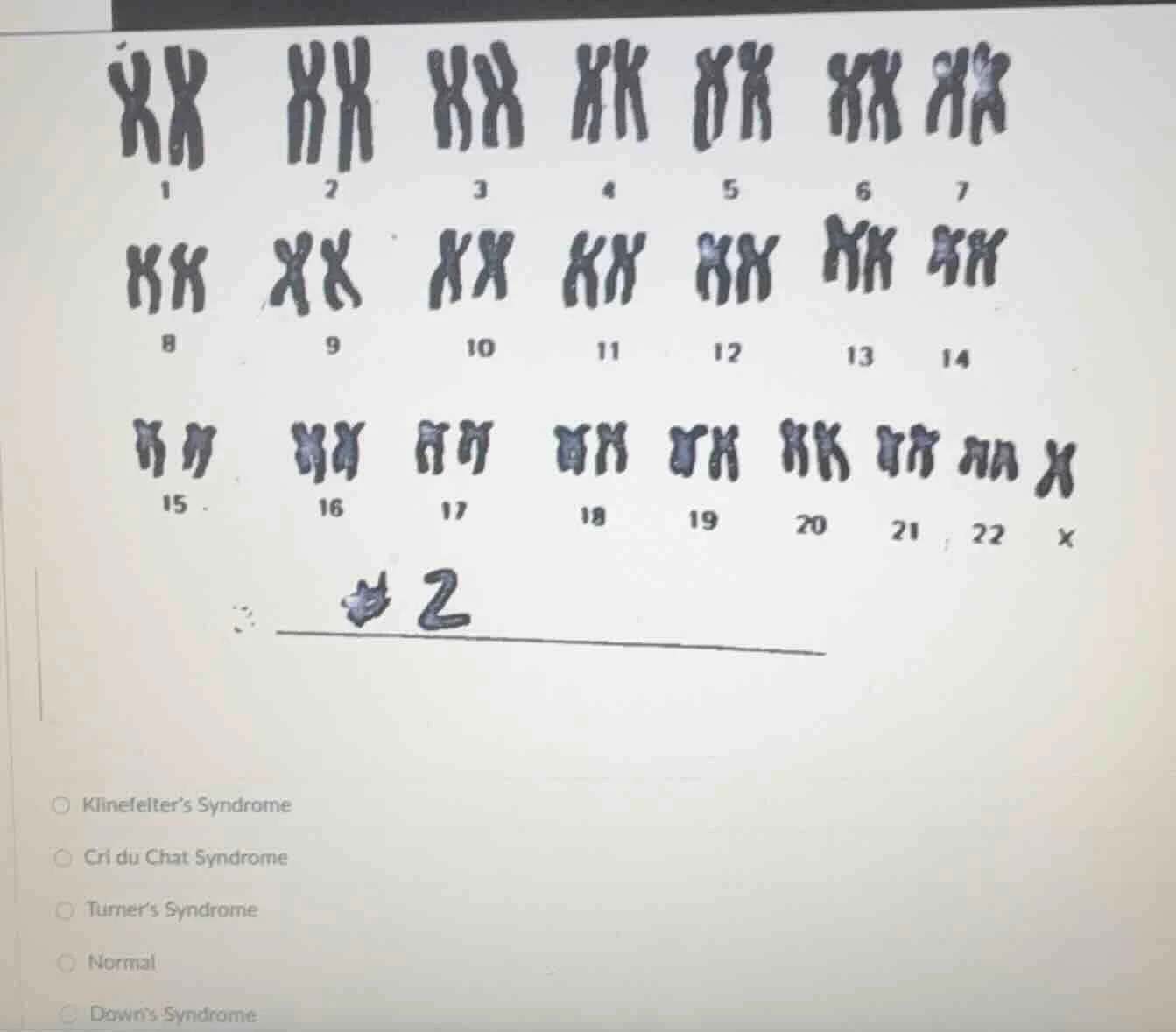 1 2 3 4 5 6 7 8 9 10 11 12 13 14 15 16 17 18 19 20 21 22 x klinefelters…