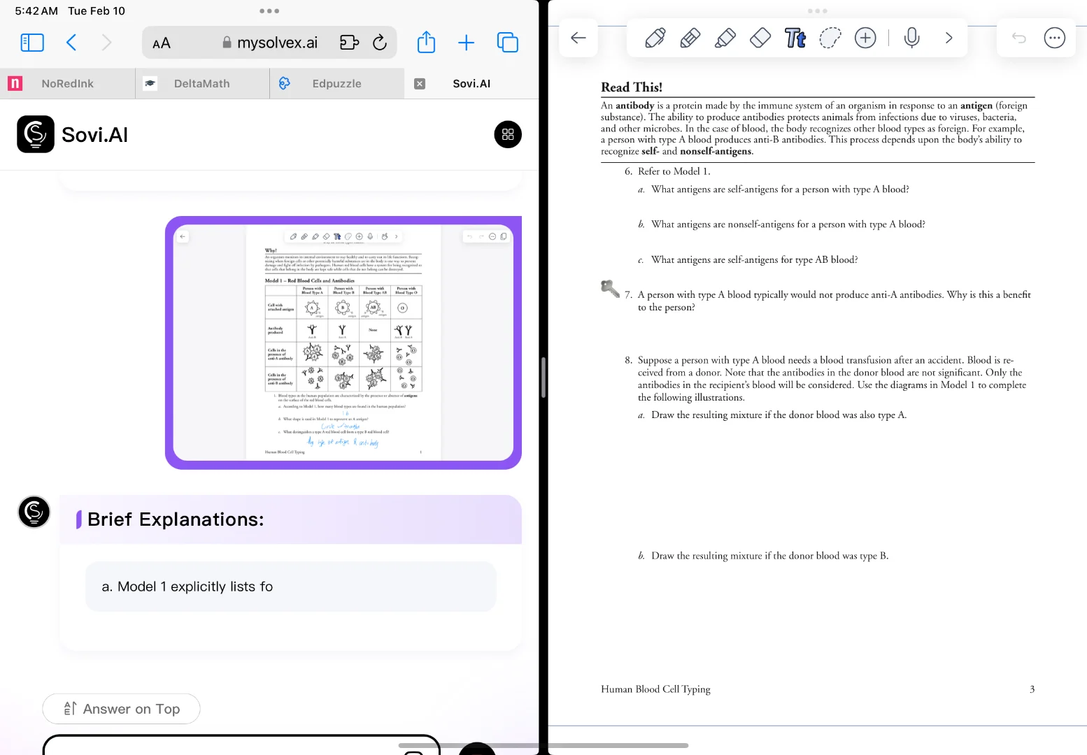 read this! an antibody is a protein made by the immune system of an org…