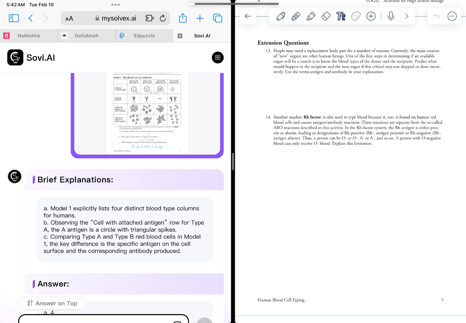 extension questions 13. people may need a replacement body part for a n…