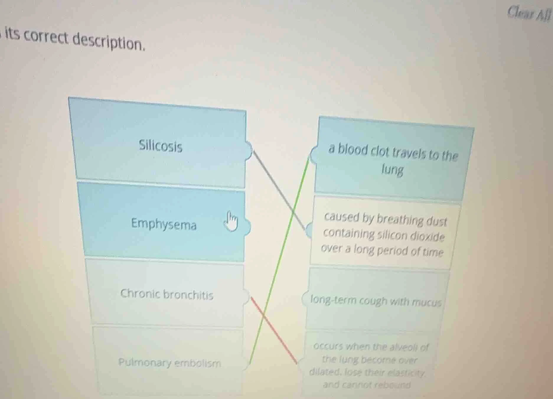 its correct description. silicosis emphysema chronic bronchitis pulmona…