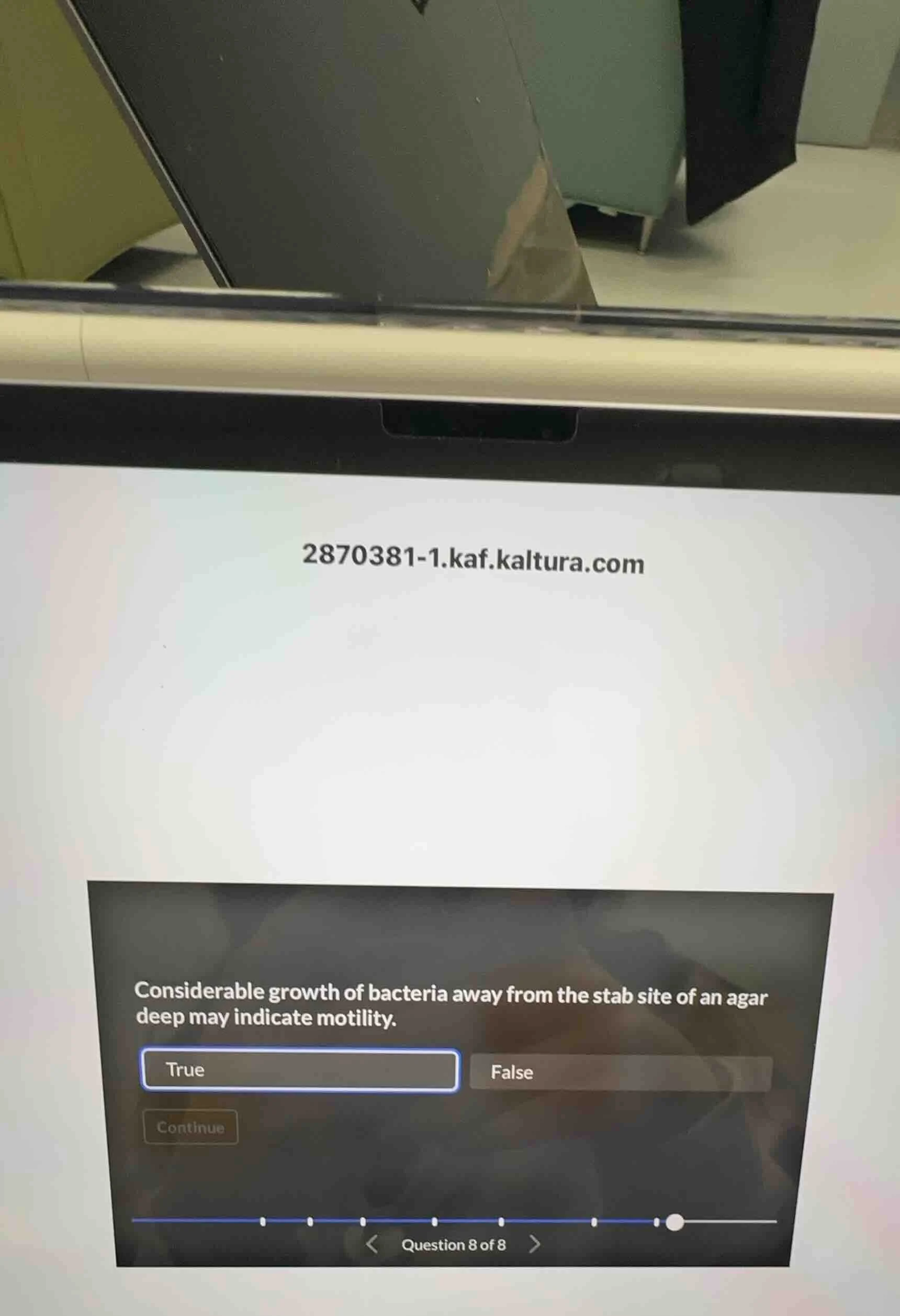 2870381-1.kaf.kaltura.com considerable growth of bacteria away from the…