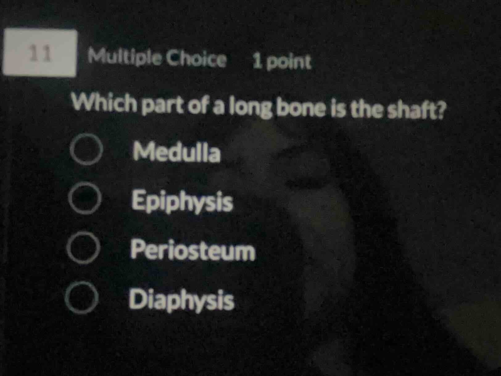 11 multiple choice 1 point which part of a long bone is the shaft? medu…