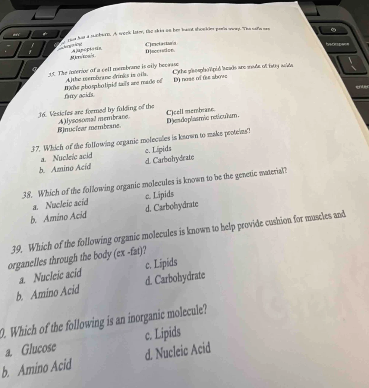 34. tina has a sunburn. a week later, the skin on her burnt shoulder pe…