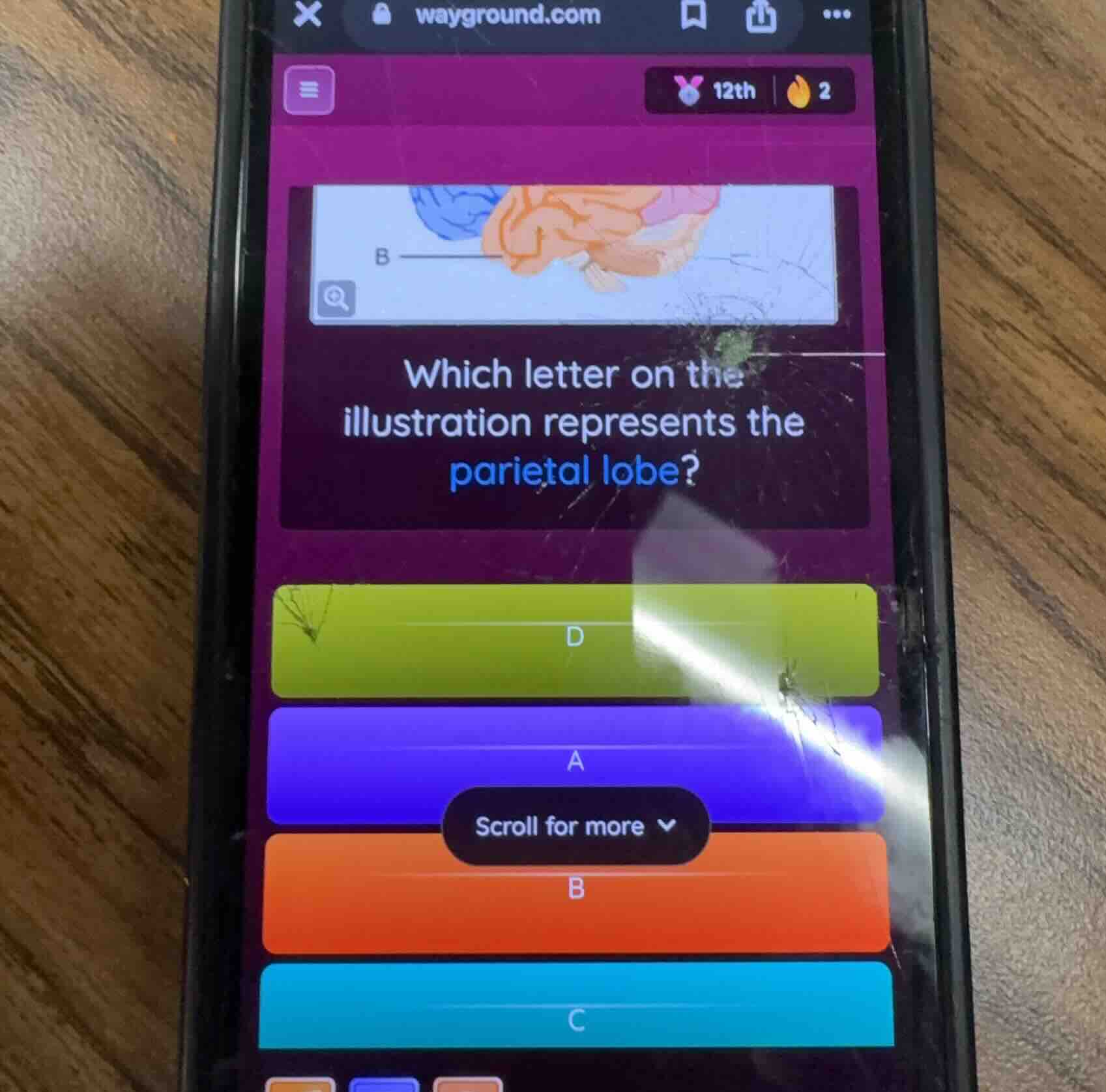 which letter on the illustration represents the parietal lobe? d a scro…