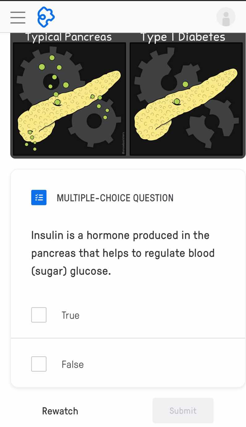 typical pancreas type 1 diabetes multiple-choice question insulin is a …