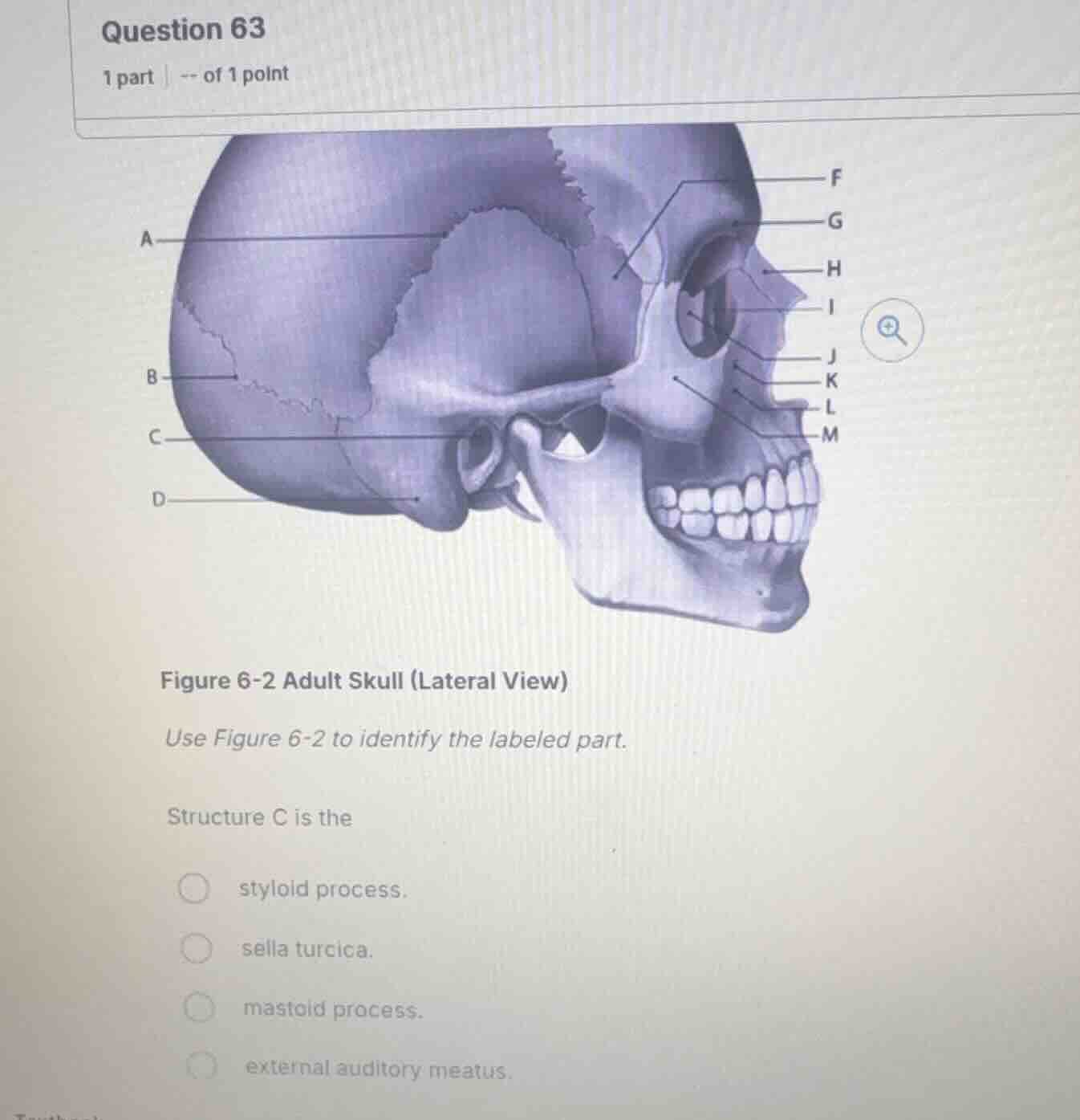 question 63 1 part -- of 1 point figure 6-2 adult skull (lateral view) …