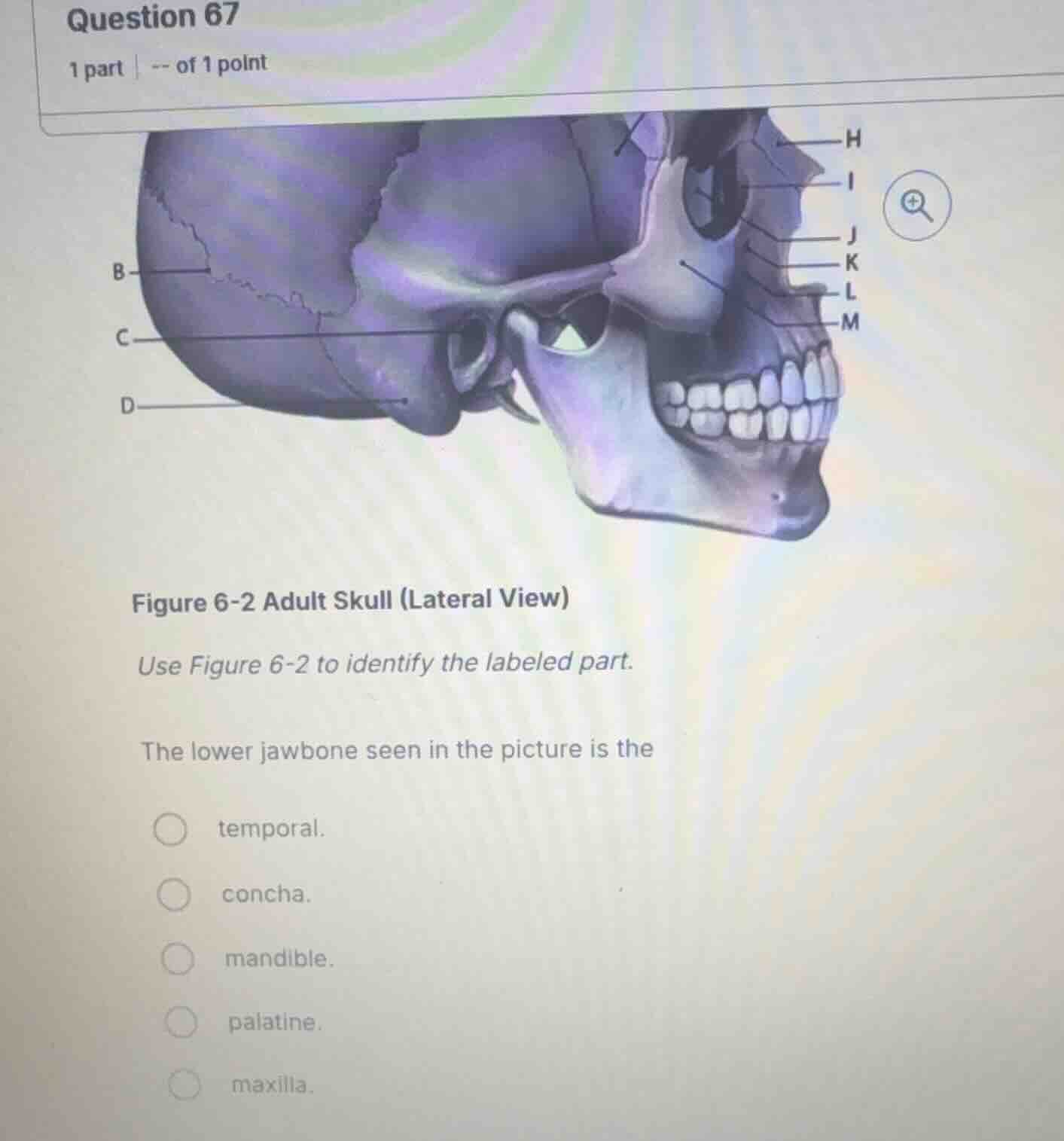 question 67 1 part | -- of 1 point figure 6-2 adult skull (lateral view…