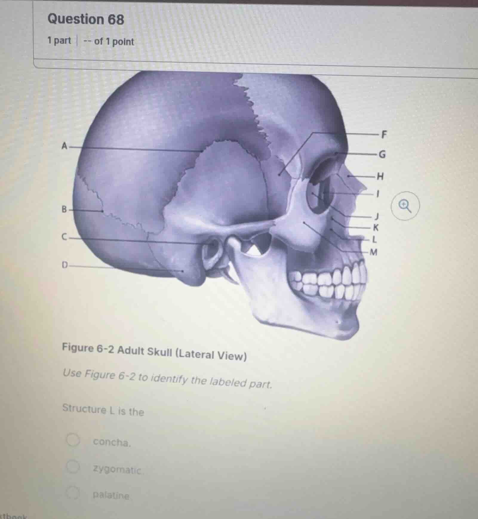question 68 1 part | -- of 1 point figure 6-2 adult skull (lateral view…