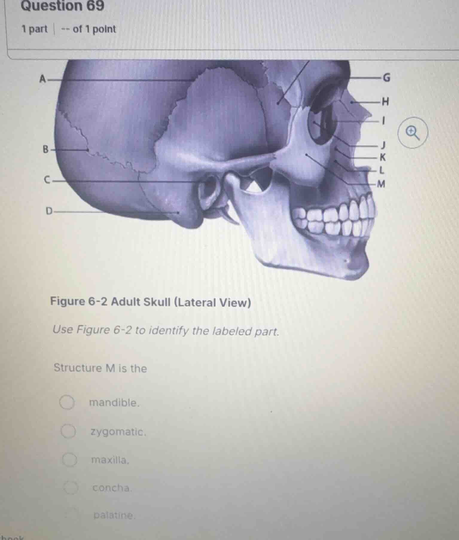 question 69 1 part | -- of 1 point figure 6-2 adult skull (lateral view…