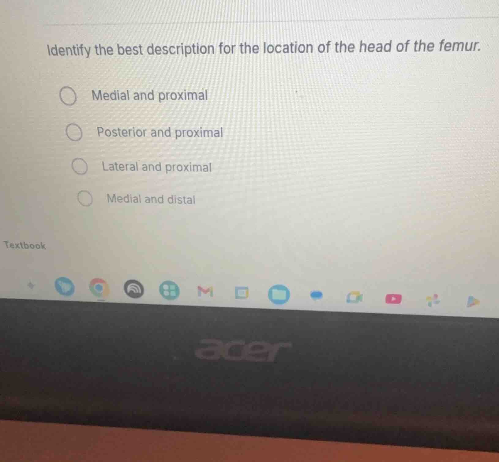 identify the best description for the location of the head of the femur…