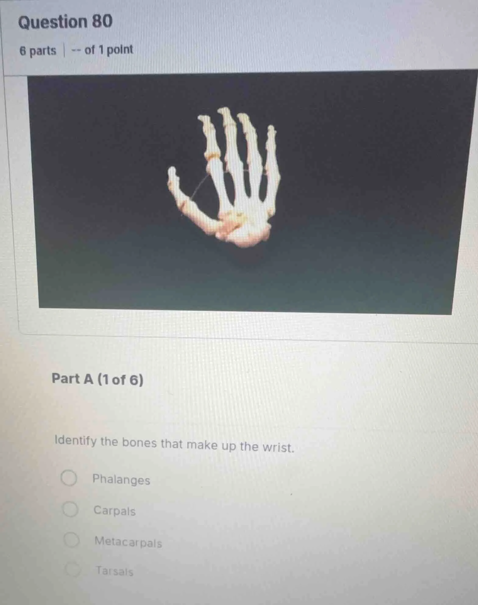 question 80 6 parts | -- of 1 point part a (1 of 6) identify the bones …
