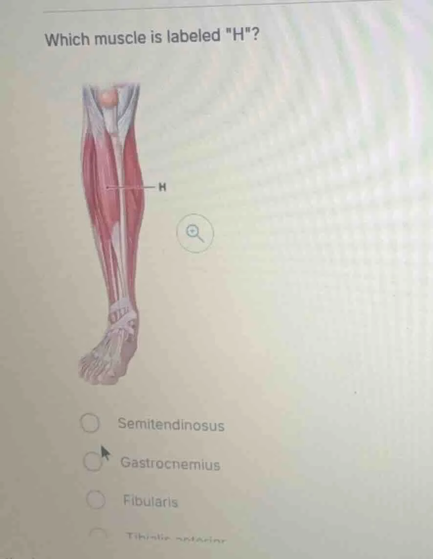 which muscle is labeled \h\? semitendinosus gastrocnemius fibularis tib…