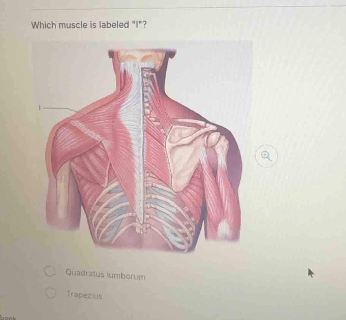 which muscle is labeled \i\? quadratus lumborum trapezius