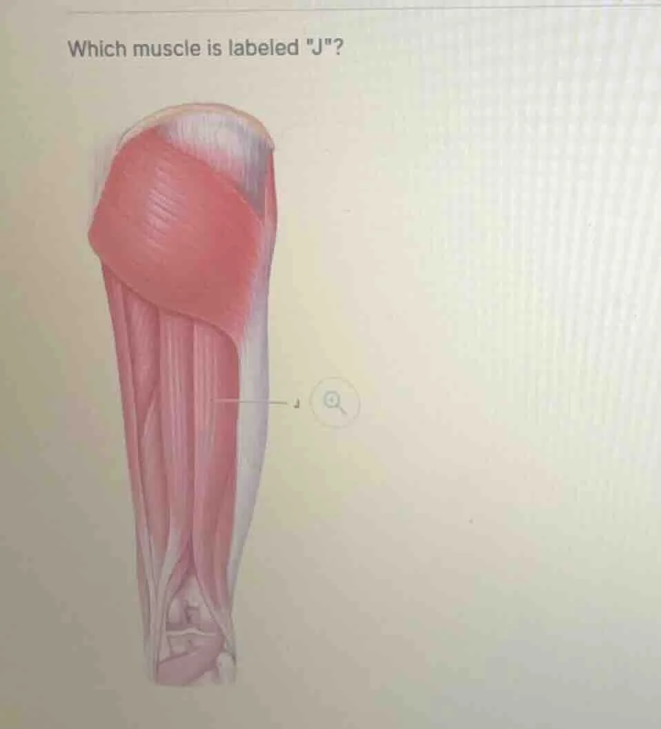 which muscle is labeled \j\?